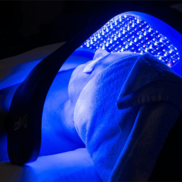 Φωτοδυναμική Θεραπεία ακμής dermaesthete clinic dermatologos pinakoulaki