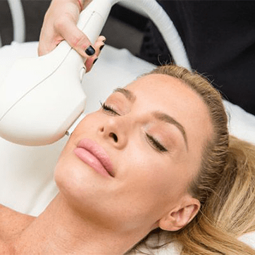 Φωτοαναζωογόνηση IPL Venus Versa δερματολογος Πειραια