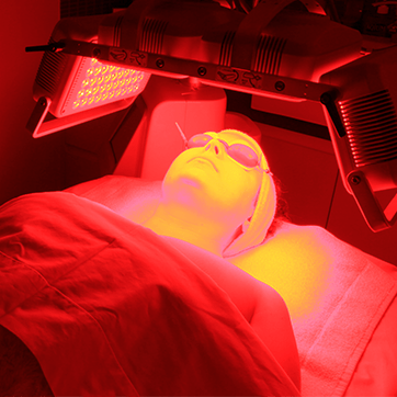 Φωτοδυναμικό Peeling
